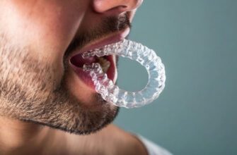 Фото элайнеров Invisalign для исправления прикуса и лечения зубов