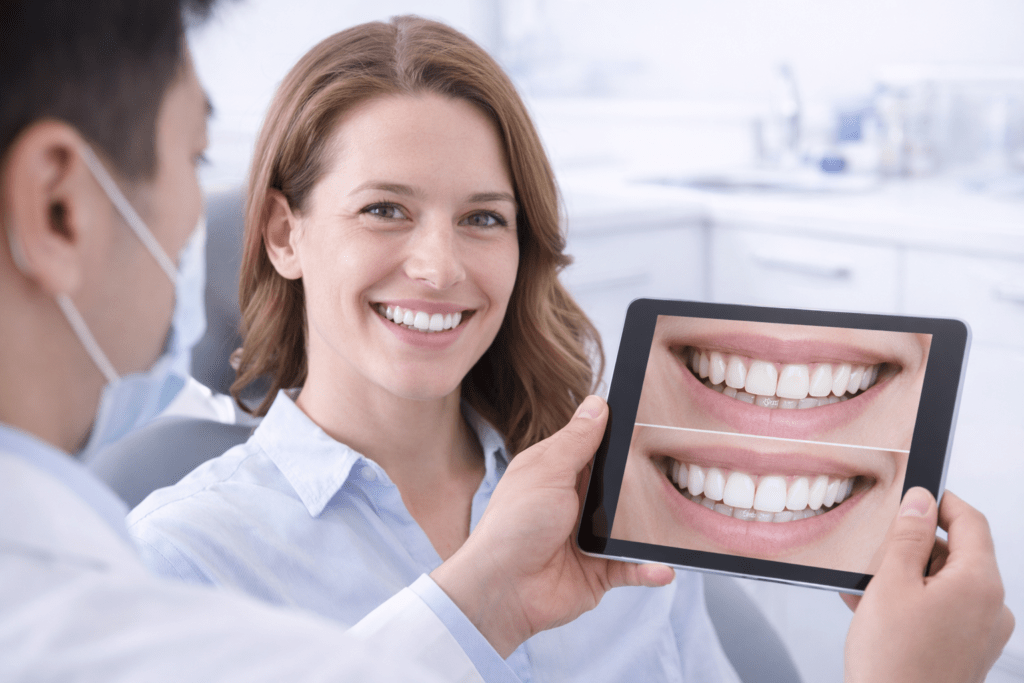 Эстетикалық стоматология Алматы: винир және тіс ағарту нәтижесі