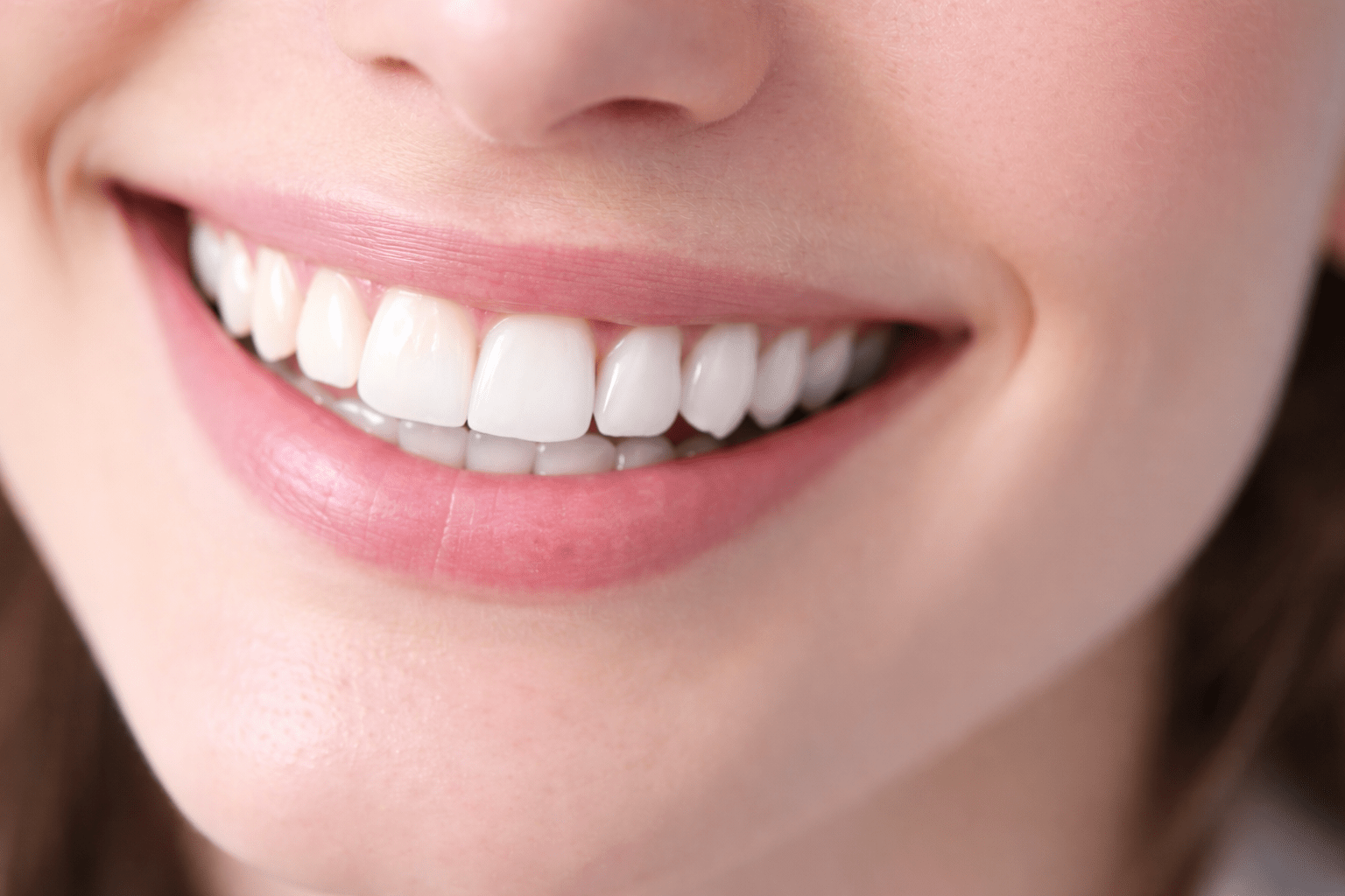 Голливудская улыбка Алматы — виниры и эстетическая реставрация передних зубов